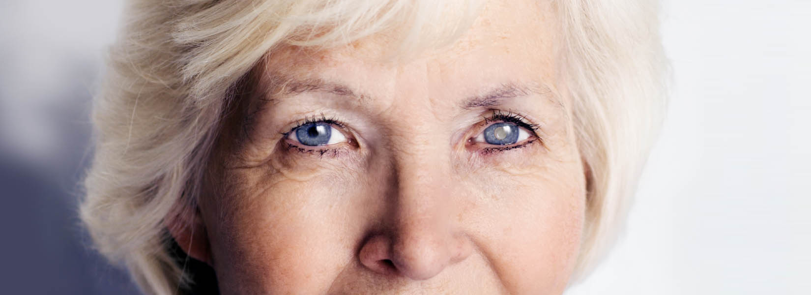 Cataract Surgery in Downtown Columbia